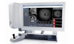 Fluorangiografia retinica